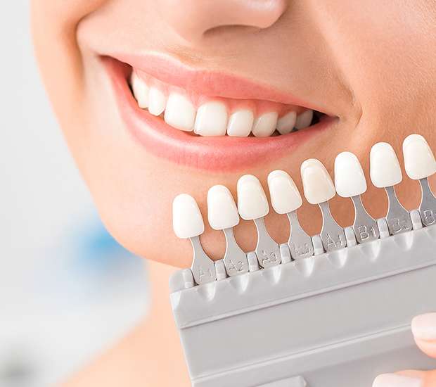 Hutto Dental Veneers and Dental Laminates