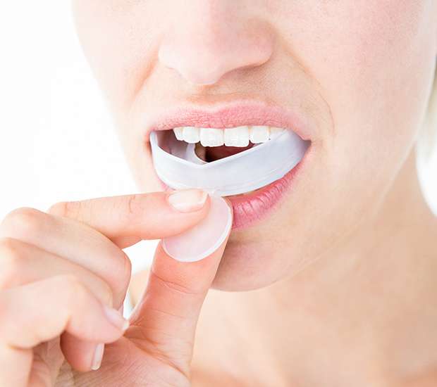 Hutto Mouth Guards